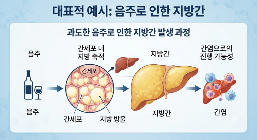 지방간 음주